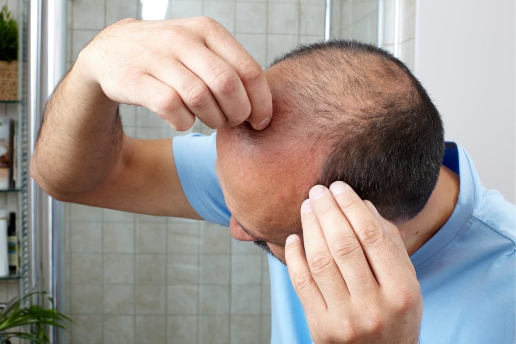 Insights into hair loss treatment by Expert